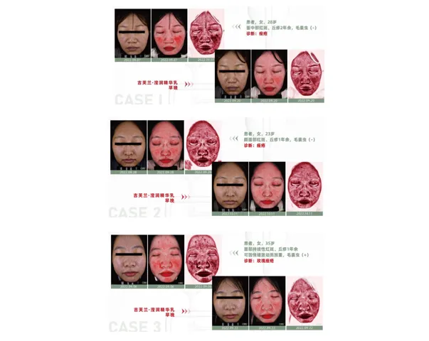 临床实证