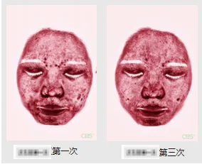 临床案例